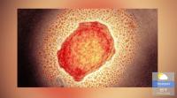 What is Monkeypox?