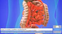 Colonoscopy Explained